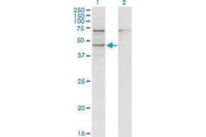 Western Blot analysis of STRADB expression in transfected 293T cell line by STRADB monoclonal antibody (M02), clone 3E11.