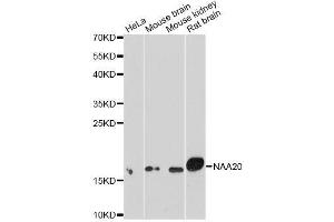 Western blot analysis of extracts of various cell lines, using NAA20 antibody. (NAT5 anticorps  (AA 49-178))