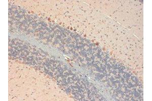 GluR2 Immunohistochemistry.