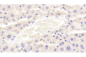 Detection of LDLRAP1 in Mouse Liver Tissue using Polyclonal Antibody to Low Density Lipoprotein Receptor Adaptor Protein 1 (LDLRAP1)
