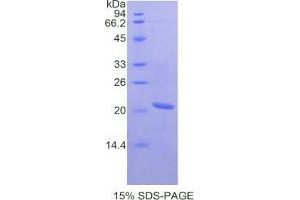 SDS-PAGE analysis of Mouse SCCA2 Protein. (SERPINB4 Protéine)