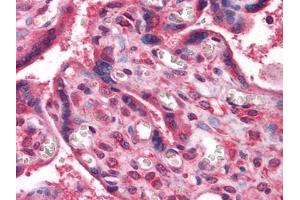 Immunohistochemical analysis of paraffin-embedded human Placenta tissues using anti-NME1 antibody (NME1 anticorps)