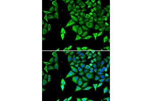 Immunofluorescence analysis of U2OS cells using NPPA antibody.