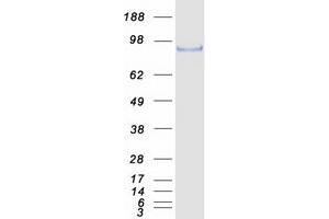 Validation with Western Blot