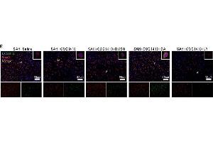 Effect of p-GSK-3β to the COG1410 promoted neuron autophagy.
