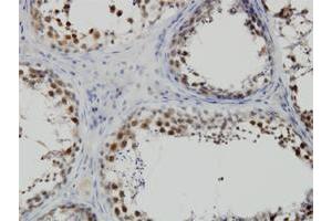 Immunoperoxidase of monoclonal antibody to PBK on formalin-fixed paraffin-embedded human testis. (PBK anticorps  (AA 1-110))