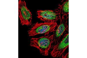 Immunofluorescence (IF) image for anti-SP140 Nuclear Body Protein (SP140) antibody (ABIN2997006) (SP140 anticorps)