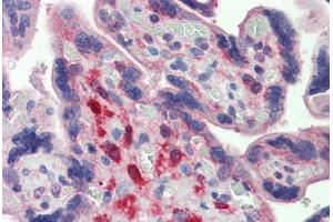 Human Placenta: Formalin-Fixed, Paraffin-Embedded (FFPE)