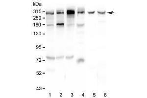 Western blot testing of human 1) HeLa, 2) U-87 MG, 3) HepG2, 4) 22RV1, 5) rat brain and 6) mouse brain lysate with M6PR antibody at 0. (IGF2R anticorps)