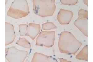 IHC-P analysis of Rat Skeletal muscle Tissue, with DAB staining. (RNASE3 anticorps  (AA 33-155))