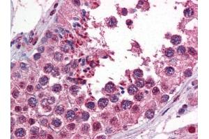 anti-Calcium/calmodulin-Dependent Protein Kinase II beta (CAMK2B) (AA 1-504) antibody