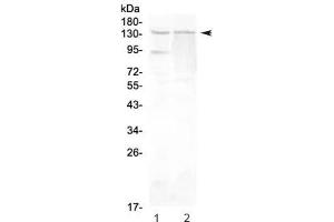 Western blot testing of rat 1) testis and 2) PC-12 lysate with RTEL1 antibody at 0.