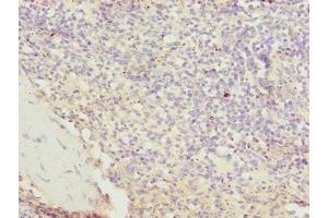 Immunohistochemistry of paraffin-embedded human spleen tissue using ABIN7170488 at dilution of 1:100 (STPG2 anticorps  (AA 201-459))
