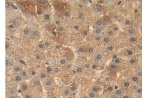 anti-Bone Morphogenetic Protein 4 (BMP4) (AA 22-408) antibody