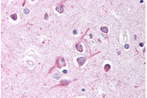 Human Brain, Cortex (formalin-fixed, paraffin-embedded) stained with AFF1 antibody ABIN214636 at 10 ug/ml followed by biotinylated goat anti-rabbit IgG secondary antibody ABIN481713, alkaline phosphatase-streptavidin and chromogen. (AF4 anticorps  (AA 1190-1203))