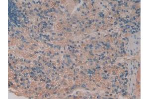 DAB staining on IHC-P; Samples: Rat Spleen Tissue