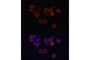 Immunofluorescence analysis of HeLa cells using LAMP1 antibody.