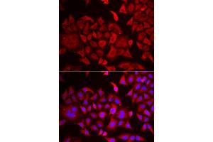 Immunofluorescence analysis of HeLa cells using TARS antibody (ABIN6132713, ABIN6148858, ABIN6148859 and ABIN6222758). (TARS anticorps  (AA 1-230))