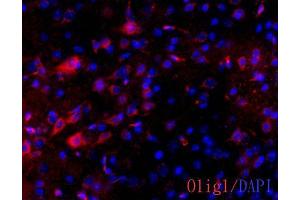 IHC-Fr Image OLIG1 antibody [C2C3] detects OLIG1 protein on adult mouse brain by immunohistochemical analysis. (OLIG1 anticorps  (C-Term))