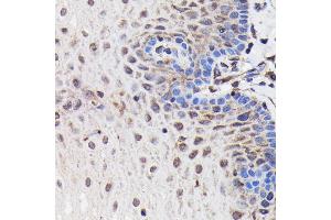 Immunohistochemistry of paraffin-embedded human esophageal using PI3 Kinase p85 beta Rabbit mAb (ABIN1679407, ABIN3019246, ABIN3019247 and ABIN7101736) at dilution of 1:100 (40x lens).