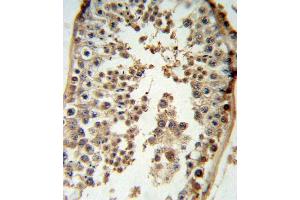 p19 Antibody (N-term) (ABIN6243142 and ABIN6579057) IHC analysis in formalin fixed and paraffin embedded testis tissue followed by peroxidase conjugation of the secondary antibody and DAB staining. (CDKN2D anticorps  (N-Term))