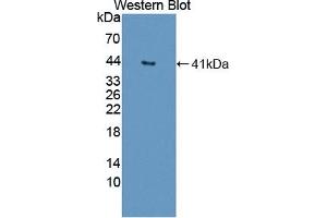Detection of Recombinant DNASEII, Human using Polyclonal Antibody to Deoxyribonuclease II (DNASEII)