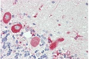 Human Brain, Cerebellum: Formalin-Fixed, Paraffin-Embedded (FFPE)