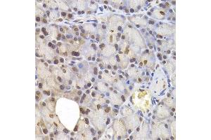 Immunohistochemistry of paraffin-embedded rat pancreas using IRF6 antibody at dilution of 1:200 (400x lens). (IRF6 anticorps)
