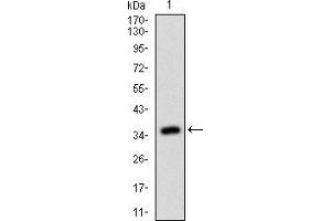 Western blot analysis using RHOF mAb against human RHOF (AA: 1-84) recombinant protein. (RhoF anticorps  (AA 1-84))