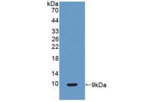 Detection of Recombinant CC16, Human using Polyclonal Antibody to Clara Cell Protein 16 (CC16) (SCGB1A1 anticorps  (AA 23-91))