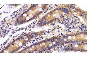Detection of EPCAM in Porcine Small intestine Tissue using Polyclonal Antibody to Epithelial Cell Adhesion Molecule (EPCAM) (EpCAM anticorps  (AA 25-265))