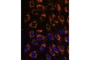 Immunofluorescence analysis of U-2 OS cells using  antibody (ABIN7265368) at dilution of 1:100.