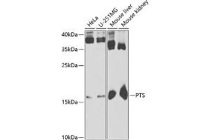 Western blot analysis of extracts of various cell lines, using PTS antibody (ABIN6129844, ABIN6146483, ABIN6146485 and ABIN6221911) at 1:1000 dilution.
