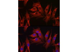 Immunofluorescence analysis of NIH-3T3 cells using HMGCR Rabbit pAb (ABIN3022293, ABIN3022294, ABIN3022295, ABIN1513022 and ABIN6218714) at dilution of 1:100 (40x lens).