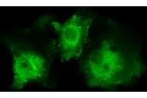 Image no. 1 for anti-Pleckstrin (PLEK) antibody (ABIN1500272) (Pleckstrin anticorps)