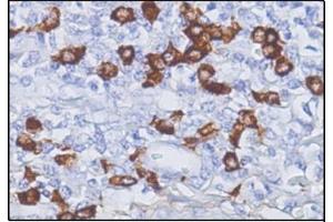 Immunohistochemistry (IHC) image for Mouse anti-Human IgG4 antibody (ABIN952860) (Souris anti-Humain IgG4 Anticorps)