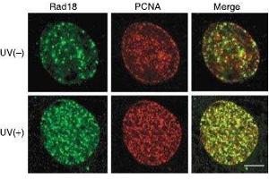 Immunofluorescence (IF) image for anti-E3 ubiquitin-protein ligase RAD18 (RAD18) (C-Term) antibody (ABIN2452086) (RAD18 anticorps  (C-Term))