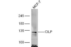 MCF-7 lysate probed with Rabbit Anti-CILP Polyclonal Antibody, Unconjugated  at 1:5000 for 90min at 37˚C. (CILP anticorps  (AA 1051-1184))