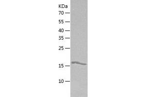 Western Blotting (WB) image for DCMP Deaminase (DCTD) (AA 1-178) protein (His tag) (ABIN7122599) (DCMP Deaminase (DCTD) (AA 1-178) protein (His tag))