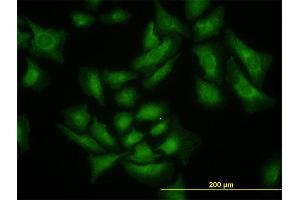 Immunofluorescence of monoclonal antibody to SMURF1 on HeLa cell.