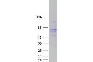 Validation with Western Blot