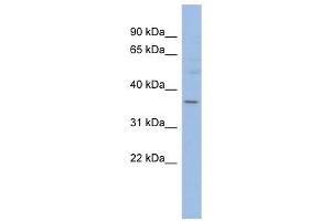 HMGCLL1 antibody used at 1 ug/ml to detect target protein. (HMGCLL1 anticorps  (N-Term))