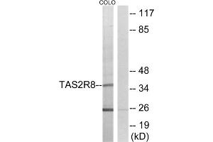 Western blot analysis of extracts from COLO cells, using TAS2R8 antibody. (TAS2R8 anticorps  (Internal Region))