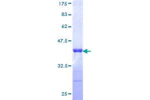 Image no. 1 for Tripartite Motif Containing 21 (TRIM21) (AA 68-175) protein (GST tag) (ABIN1323622)