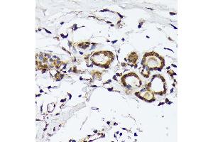 Immunohistochemistry of paraffin-embedded human breast using PSMD14 Rabbit mAb (ABIN7269588) at dilution of 1:100 (40x lens).