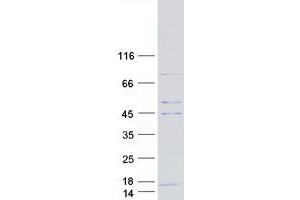 Validation with Western Blot
