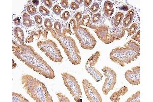 IHC analysis of CDK5 using anti-CDK5 antibody (ABIN6719393). (CDK5 anticorps  (AA 1-226))
