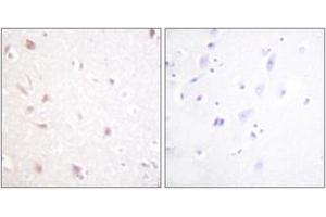 Immunohistochemistry (IHC) image for anti-MKI67 FHA Domain-Interacting Nucleolar Phosphoprotein (MKI67IP) (AA 200-249) antibody (ABIN2888898) (NIFK anticorps  (AA 200-249))
