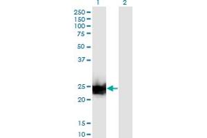 Western Blot analysis of LGALS3 expression in transfected 293T cell line by LGALS3 monoclonal antibody (M03), clone 3G8. (Galectin 3 anticorps  (AA 1-250))