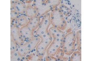 Used in DAB staining on fromalin fixed paraffin- embedded kidney tissue